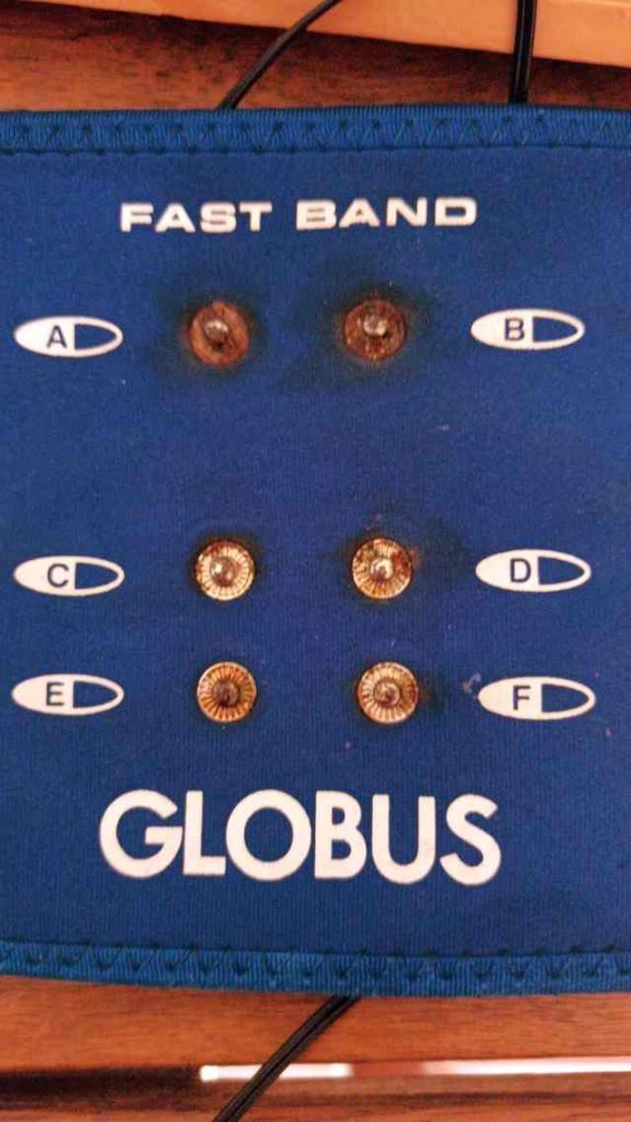 conexiones faja globus oxidadas